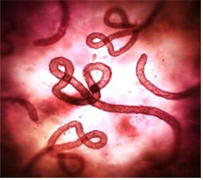 							에볼라 바이러스
